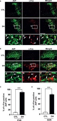 Transcription Factor TonEBP Stimulates Hyperosmolality-Dependent Arginine Vasopressin Gene Expression in the Mouse Hypothalamus